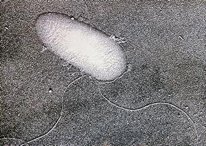  Pseudomonas aeruginosa